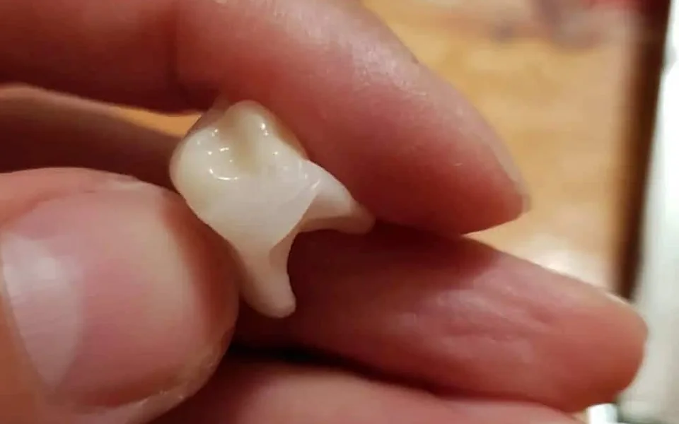 Dinte Denticor real cu sistemul de prindere DentiFlex, ținut între degete