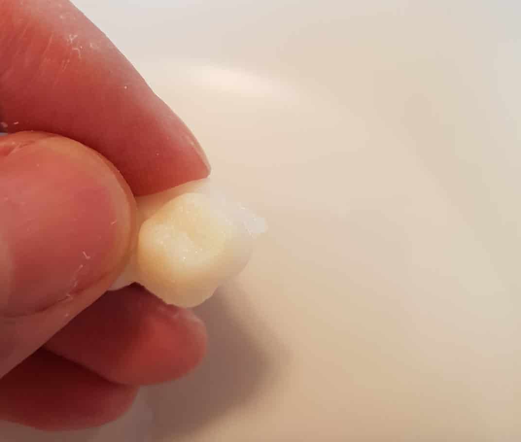 Primul prototip de proteză dentară Denticor
