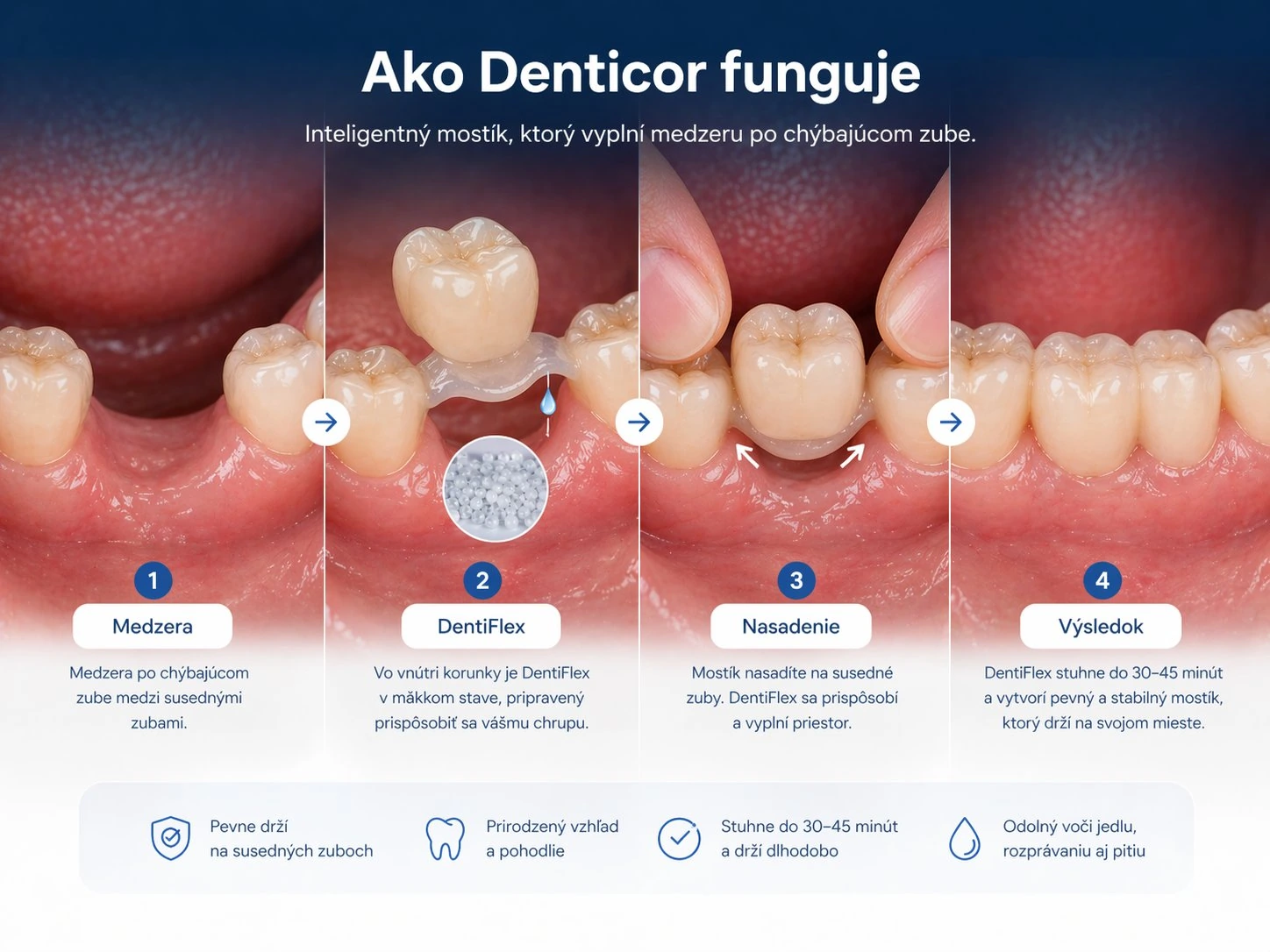 Cum funcționează Denticor în cazul lipsei a trei dinți superiori posteriori