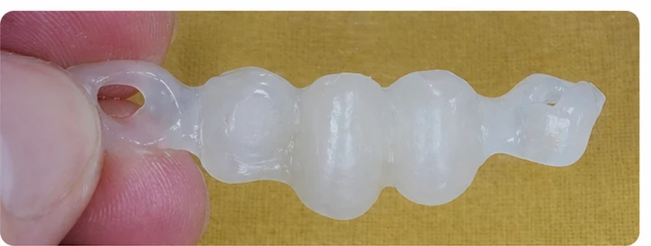 Procedură vizuală pentru două premolari și un molar superior – principiul inserării punții Denticor cu dinți noi și modelarea acesteia în jurul dinților învecinați