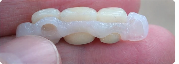 Demonstrație de adaptare Denticor: poziționarea piesei și modelarea sprijinului din DentiFlex · 4