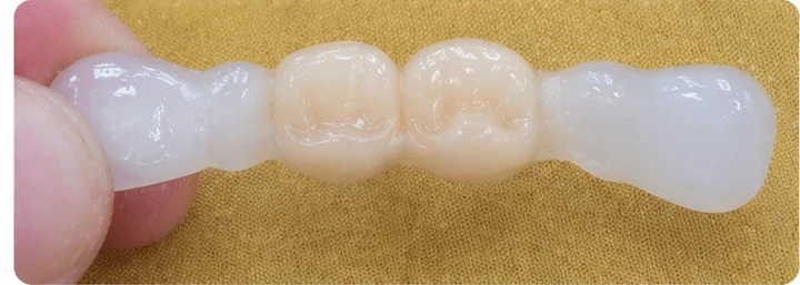 Demonstrație de adaptare Denticor: poziționarea piesei și modelarea sprijinului din DentiFlex · 3