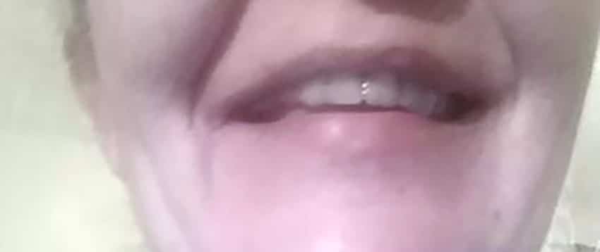 Clienta – dinte frontal înlocuit cu Denticor