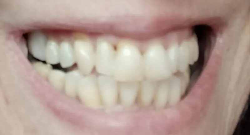 Cliență – spațiul acoperit cu Denticor